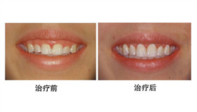 ��ǻ�����x�����ȈD