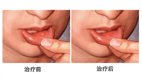 ��ǻ�����x�����ȈD