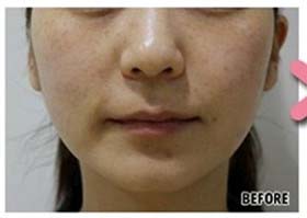 ˮ��ע��x�������ȈD1