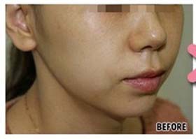 ˮ��ע��x�������ȈD1