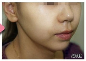 ˮ��ע��x�������ȈD2